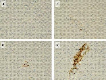 https://cdn.ncbi.nlm.nih.gov/pmc/blobs/9515/8483539/4d3e7d9f0467/JAH3-10-e019627-g002.jpg