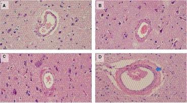 https://cdn.ncbi.nlm.nih.gov/pmc/blobs/9515/8483539/efb9a94157b0/JAH3-10-e019627-g003.jpg