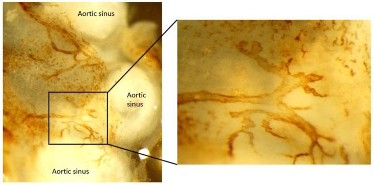 https://cdn.ncbi.nlm.nih.gov/pmc/blobs/9516/8229118/e4aed0fd7d64/cells-10-01344-g002.jpg