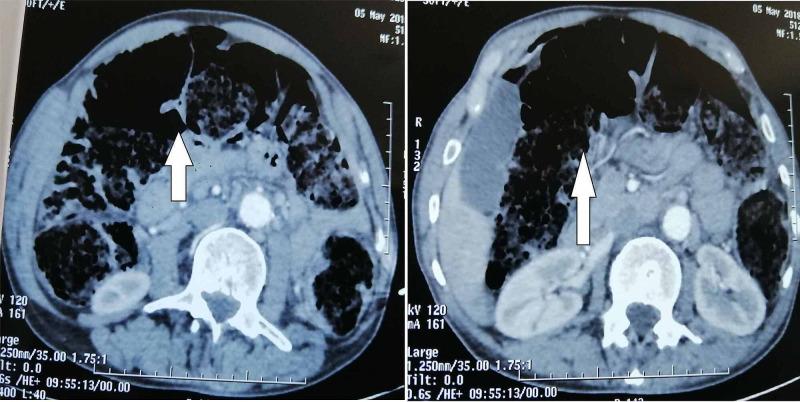 https://cdn.ncbi.nlm.nih.gov/pmc/blobs/9518/7834544/0195cbae1467/cureus-0012-00000012272-i02.jpg