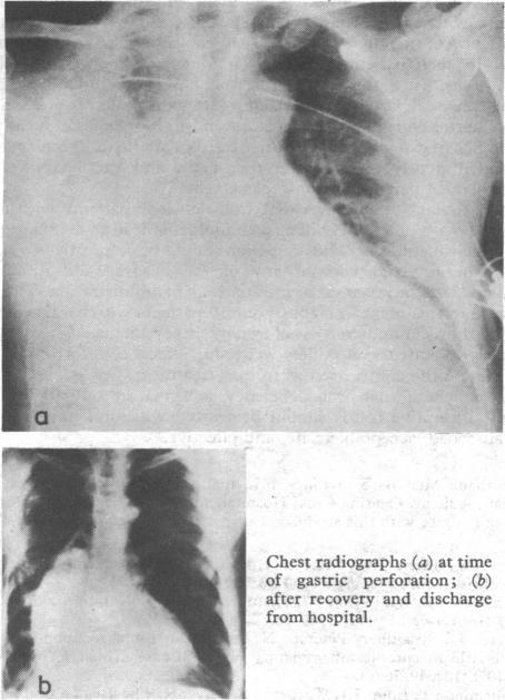 https://cdn.ncbi.nlm.nih.gov/pmc/blobs/9519/1505497/940583a42425/bmjcred00657-0023-a.jpg