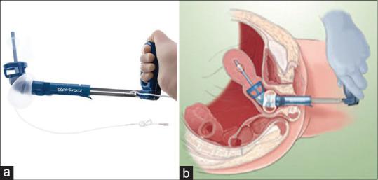 https://cdn.ncbi.nlm.nih.gov/pmc/blobs/9530/11343349/4e199e15351a/GMIT-13-161-g001.jpg