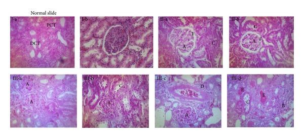 https://cdn.ncbi.nlm.nih.gov/pmc/blobs/9534/4090614/c4c30fa08c94/BMRI2014-823879.003.jpg