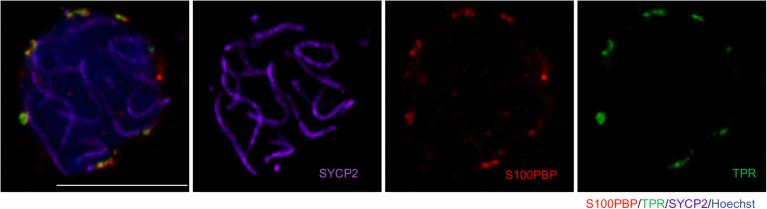 https://cdn.ncbi.nlm.nih.gov/pmc/blobs/9535/12069632/19bcf4225122/44319_2025_391_Fig10_ESM.jpg