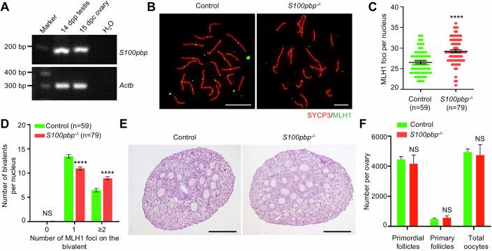 https://cdn.ncbi.nlm.nih.gov/pmc/blobs/9535/12069632/5aee49655ec5/44319_2025_391_Fig4_HTML.jpg