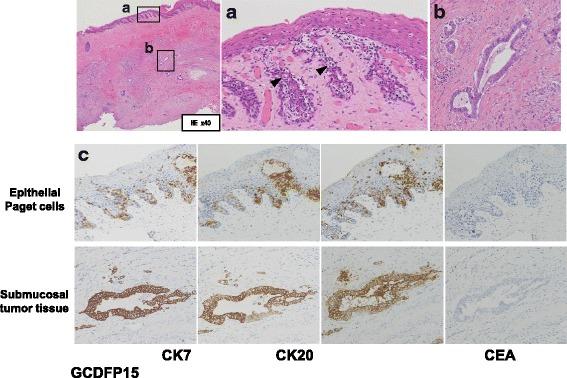https://cdn.ncbi.nlm.nih.gov/pmc/blobs/9535/5529303/7dce1695fcda/40792_2017_356_Fig2_HTML.jpg