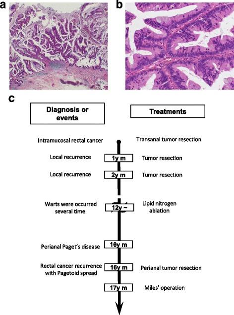 https://cdn.ncbi.nlm.nih.gov/pmc/blobs/9535/5529303/de098db495d9/40792_2017_356_Fig1_HTML.jpg