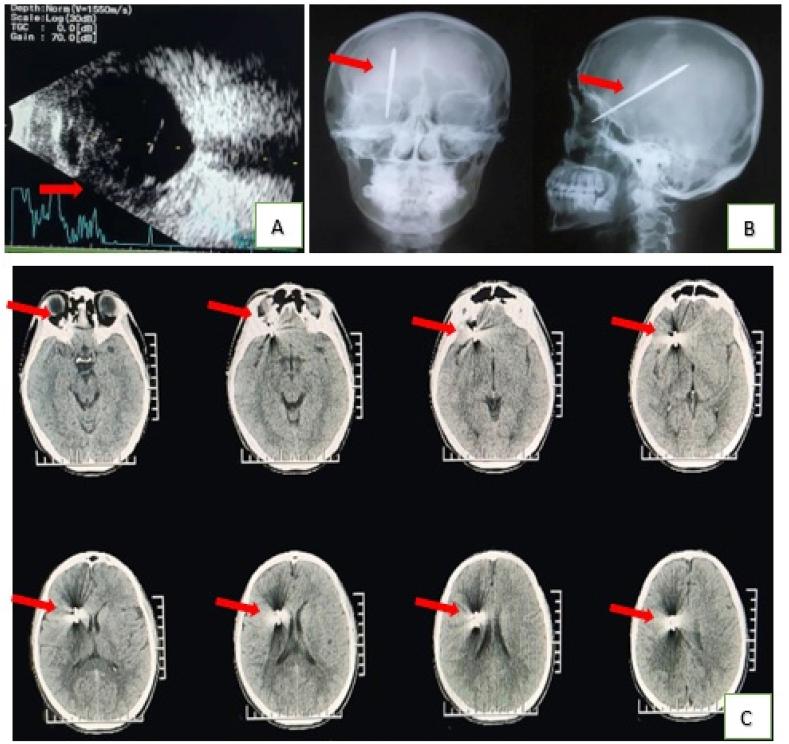 https://cdn.ncbi.nlm.nih.gov/pmc/blobs/9535/7398978/2b5351803d8a/gr2.jpg