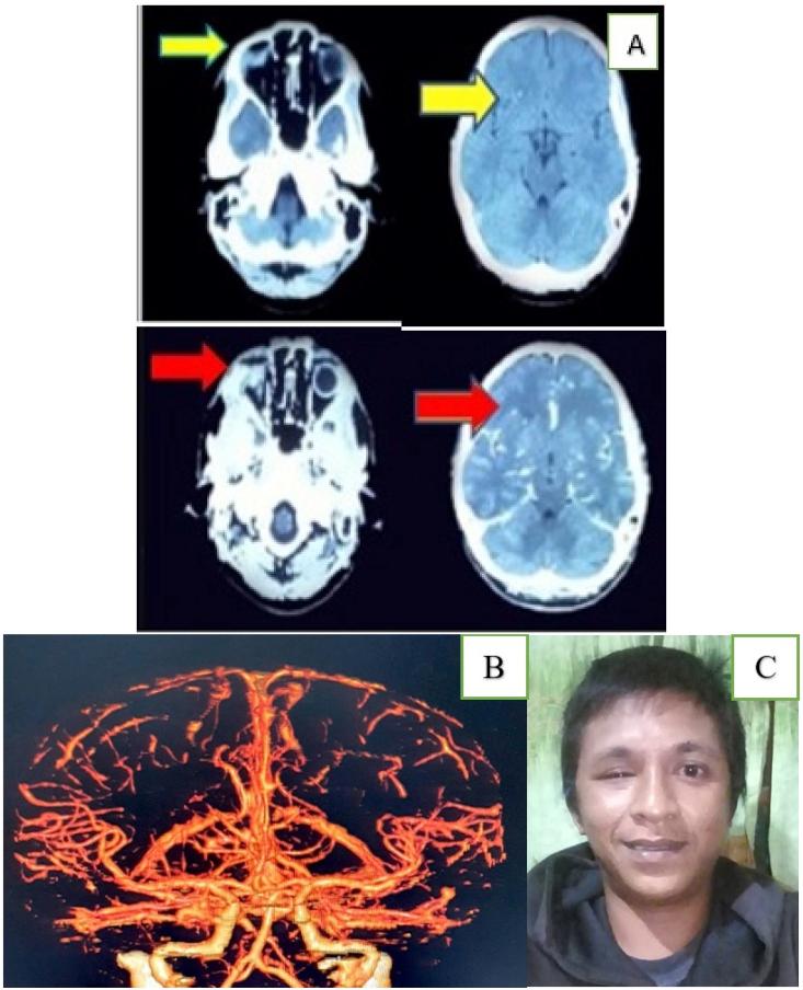https://cdn.ncbi.nlm.nih.gov/pmc/blobs/9535/7398978/aa1890eff6a9/gr4.jpg