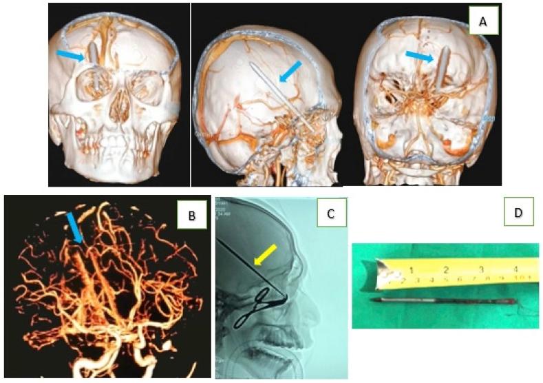 https://cdn.ncbi.nlm.nih.gov/pmc/blobs/9535/7398978/fbd9738403d0/gr3.jpg