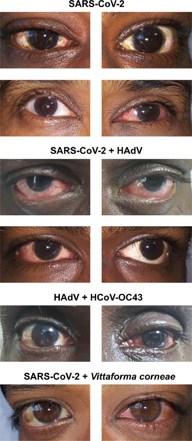 https://cdn.ncbi.nlm.nih.gov/pmc/blobs/953c/9512524/3162d43d9229/gr4_lrg.jpg