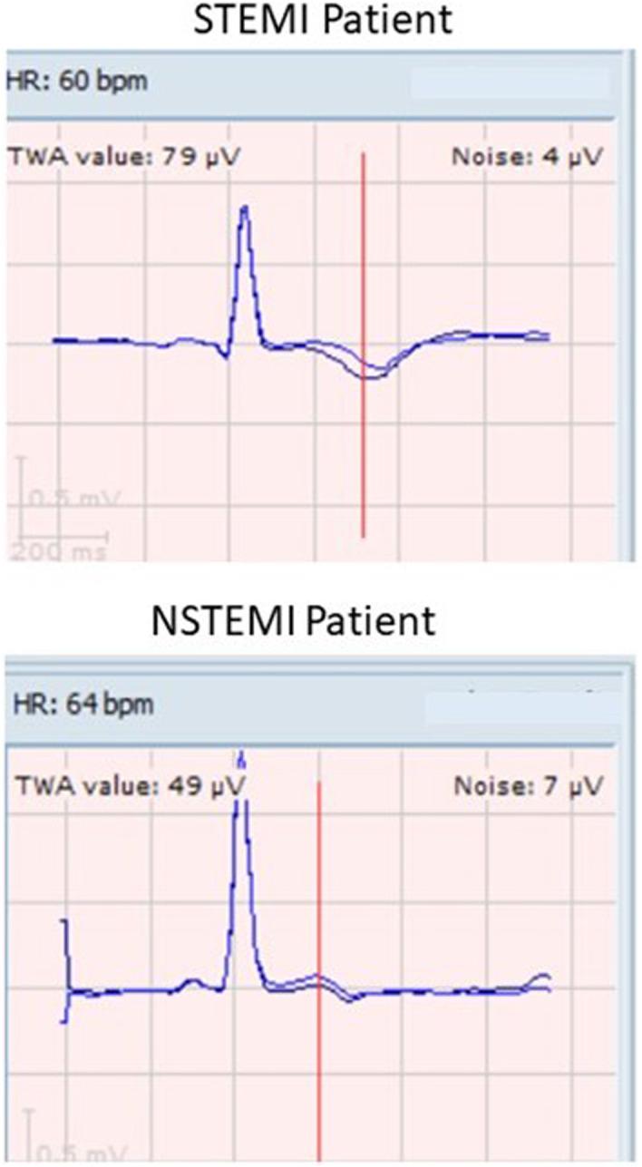 https://cdn.ncbi.nlm.nih.gov/pmc/blobs/9543/9833356/05625ffb831e/ANEC-28-e13035-g001.jpg