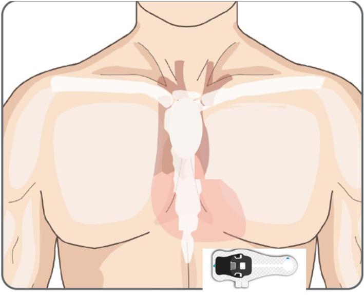 https://cdn.ncbi.nlm.nih.gov/pmc/blobs/9543/9833356/4f8dff9596b3/ANEC-28-e13035-g003.jpg