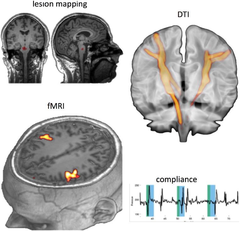 https://cdn.ncbi.nlm.nih.gov/pmc/blobs/954b/5153603/1465e877226f/gr1.jpg