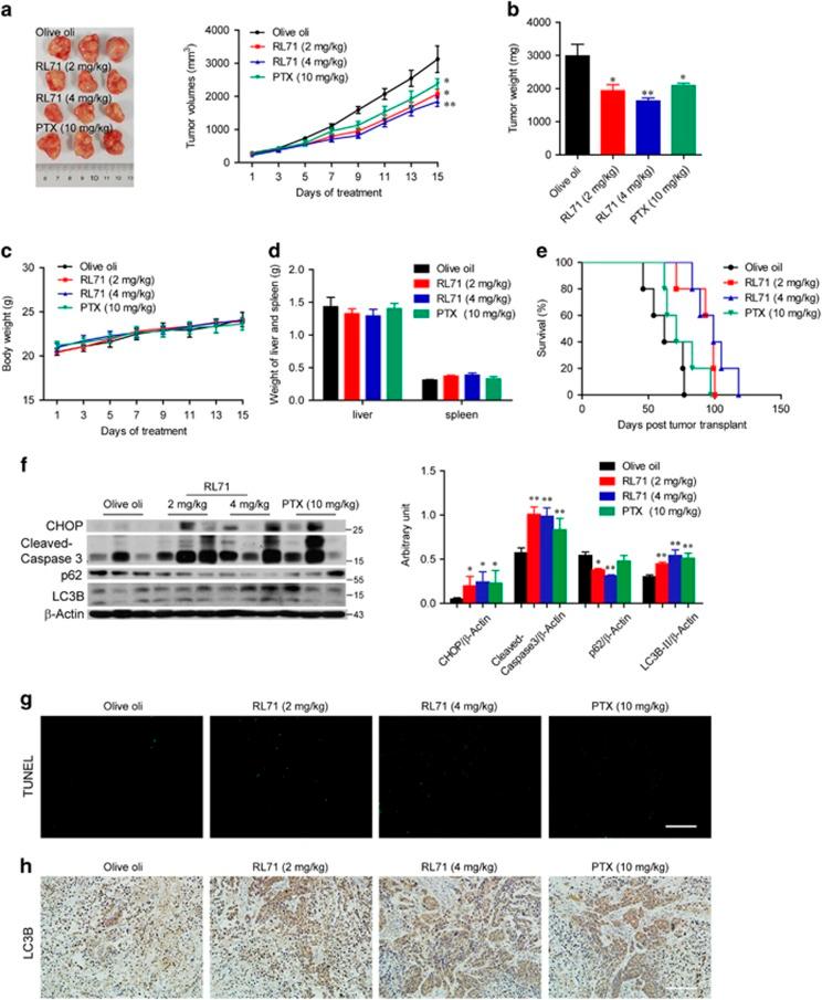 https://cdn.ncbi.nlm.nih.gov/pmc/blobs/954c/5636988/65d1adf97a70/cddis2017444f8.jpg