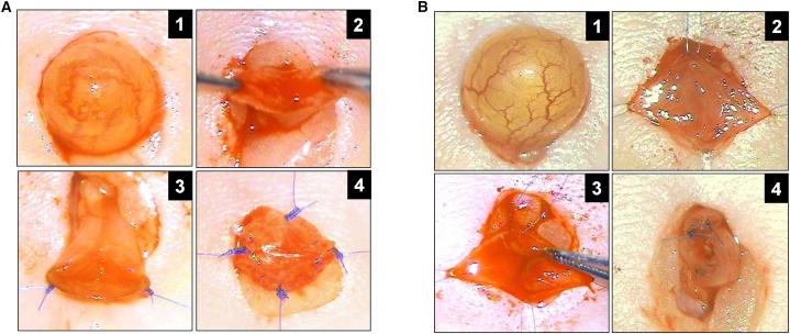https://cdn.ncbi.nlm.nih.gov/pmc/blobs/9555/5785709/78138544bb8e/gr1.jpg