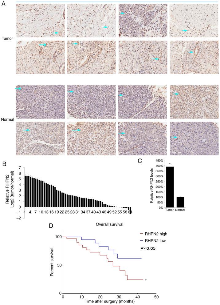 https://cdn.ncbi.nlm.nih.gov/pmc/blobs/9558/7716719/be08f0296ea5/ol-21-01-12337-g01.jpg