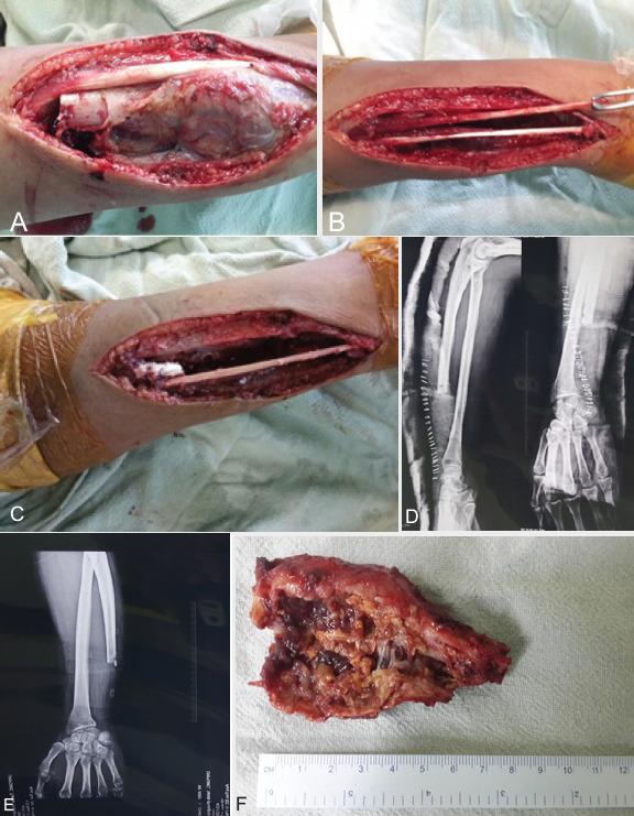 https://cdn.ncbi.nlm.nih.gov/pmc/blobs/955a/7885650/ab25ab82c67e/JOCR-10-45-g002.jpg