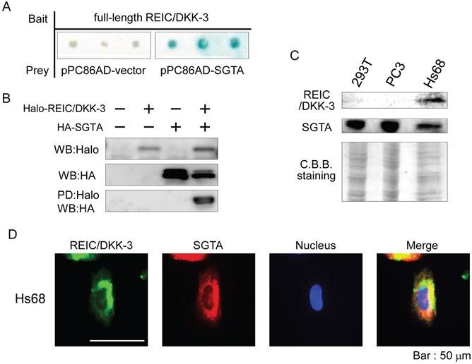 https://cdn.ncbi.nlm.nih.gov/pmc/blobs/955b/4823106/2f24cbff9d76/oncotarget-07-3283-g001.jpg