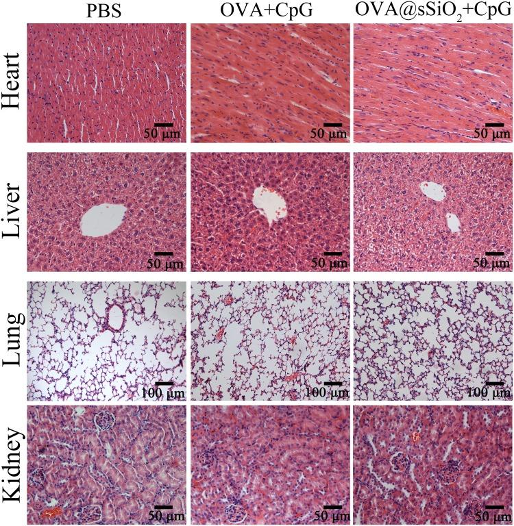https://cdn.ncbi.nlm.nih.gov/pmc/blobs/9560/7184137/ccc255bfad79/IJN-15-2685-g0007.jpg