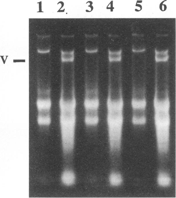 https://cdn.ncbi.nlm.nih.gov/pmc/blobs/9564/236596/7fd4185d78df/jvirol00012-0178-b.jpg
