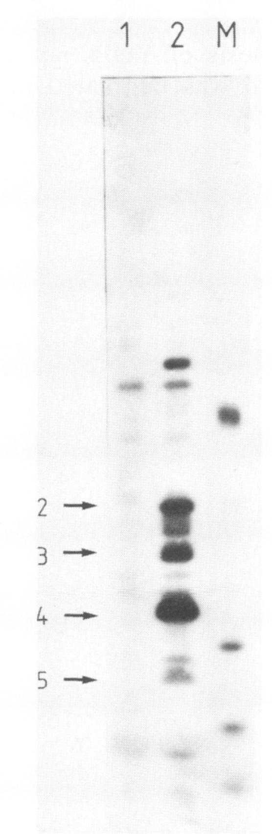 https://cdn.ncbi.nlm.nih.gov/pmc/blobs/9564/261940/d557d69141ba/iai00115-0246-b.jpg