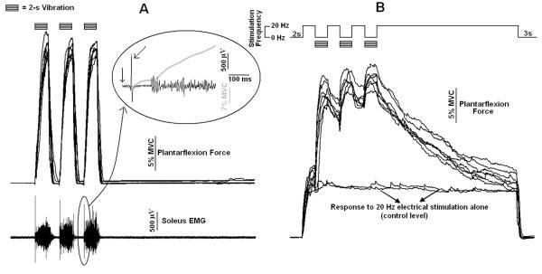 https://cdn.ncbi.nlm.nih.gov/pmc/blobs/9567/2904788/757a5e597707/1743-0003-7-26-4.jpg