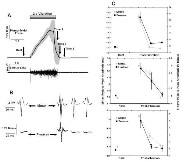https://cdn.ncbi.nlm.nih.gov/pmc/blobs/9567/2904788/8fc0ce953e54/1743-0003-7-26-7.jpg