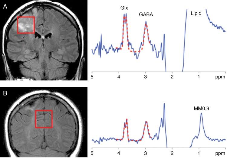 https://cdn.ncbi.nlm.nih.gov/pmc/blobs/956a/12391666/f1aad57fd043/vdaf155_fig1.jpg