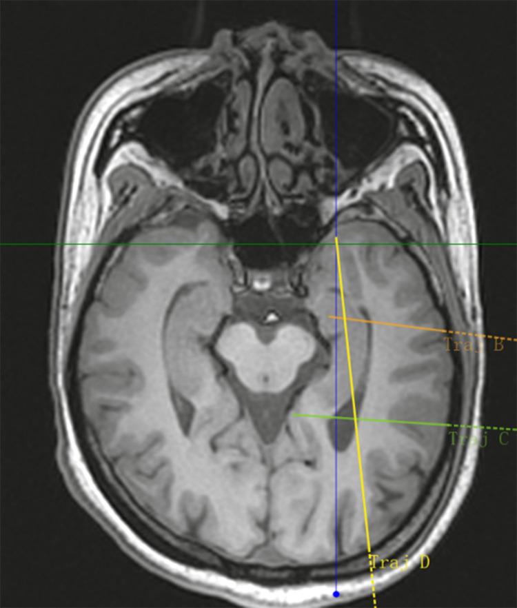 https://cdn.ncbi.nlm.nih.gov/pmc/blobs/956b/12404384/1b8e3bde4d75/pone.0331441.g001.jpg