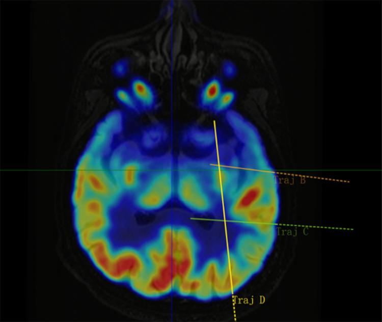 https://cdn.ncbi.nlm.nih.gov/pmc/blobs/956b/12404384/aebc587f9b79/pone.0331441.g003.jpg