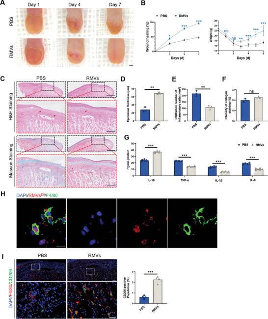 https://cdn.ncbi.nlm.nih.gov/pmc/blobs/9570/11199966/a7feb0ce8852/ADVS-11-2309725-g006.jpg