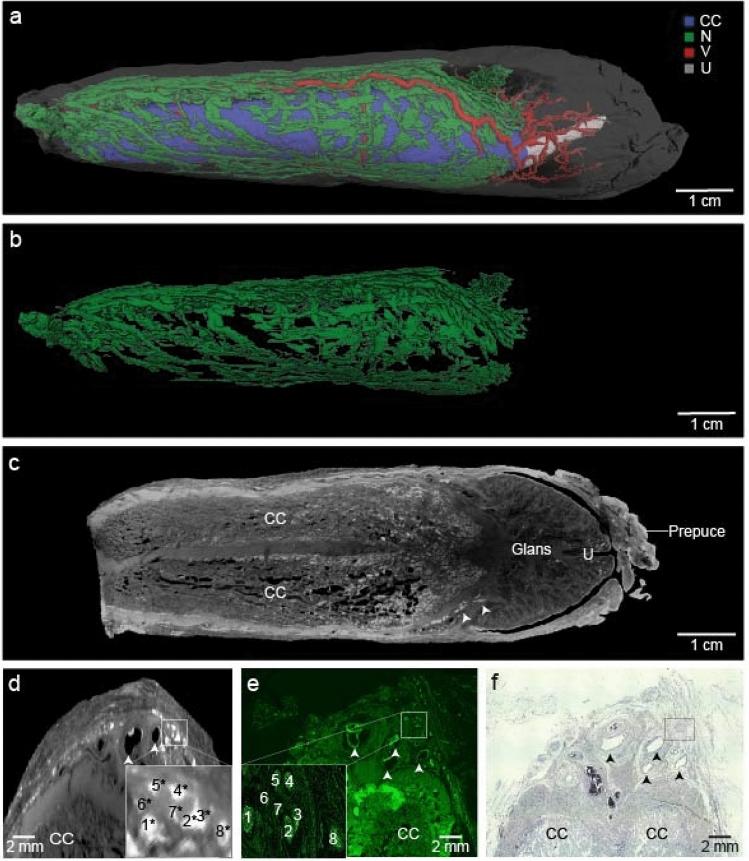 https://cdn.ncbi.nlm.nih.gov/pmc/blobs/9571/10232416/c4d9b1d20401/41598_2023_35030_Fig2_HTML.jpg
