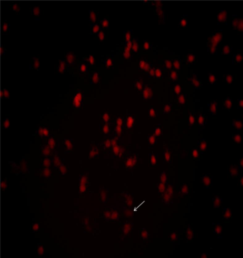 https://cdn.ncbi.nlm.nih.gov/pmc/blobs/9575/6303482/e2081e11b956/gr1.jpg