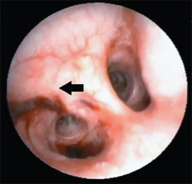 https://cdn.ncbi.nlm.nih.gov/pmc/blobs/9577/4857569/6ee933a0cbf4/LI-33-313-g004.jpg