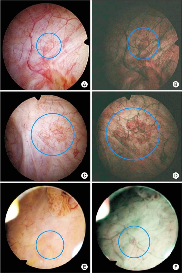 https://cdn.ncbi.nlm.nih.gov/pmc/blobs/9578/5840124/fe7760e9850f/icu-59-98-g003.jpg
