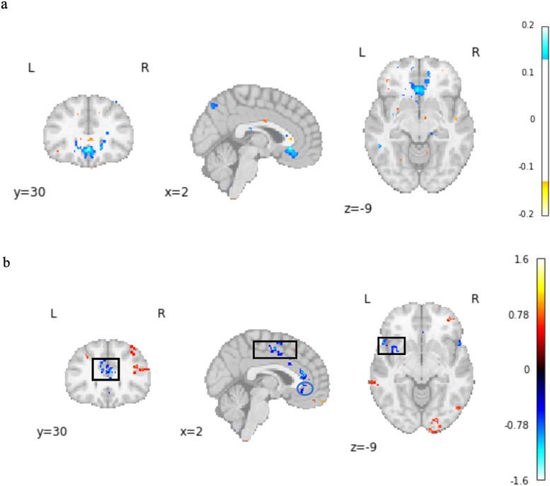 https://cdn.ncbi.nlm.nih.gov/pmc/blobs/957f/12247603/4d62226123c0/imag_a_00142_fig6.jpg