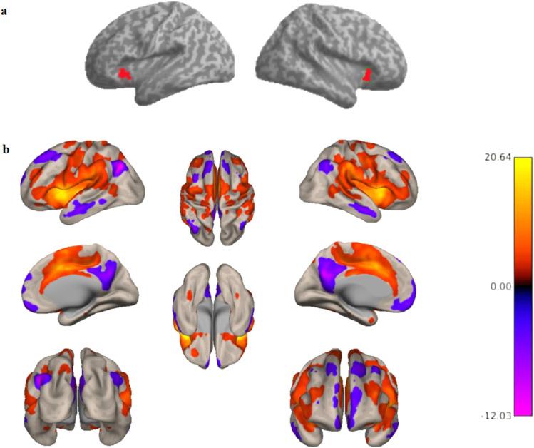 https://cdn.ncbi.nlm.nih.gov/pmc/blobs/957f/12247603/5b5b6c1c3b15/imag_a_00142_fig3.jpg