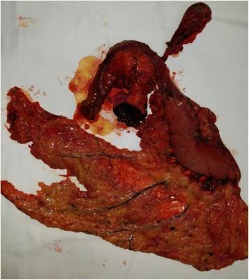 https://cdn.ncbi.nlm.nih.gov/pmc/blobs/9586/5134225/0e51c642f200/13256_2016_1121_Fig4_HTML.jpg