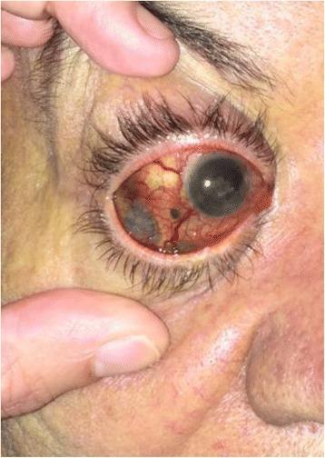 https://cdn.ncbi.nlm.nih.gov/pmc/blobs/9586/5134225/a3b753de0a15/13256_2016_1121_Fig1_HTML.jpg