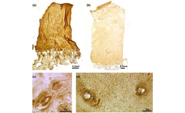 https://cdn.ncbi.nlm.nih.gov/pmc/blobs/9587/2206378/46d2e8da972f/ar2278-6.jpg