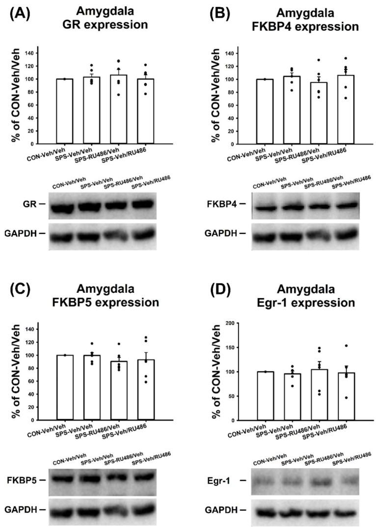 https://cdn.ncbi.nlm.nih.gov/pmc/blobs/9588/9141845/39090f9ef322/ijms-23-05494-g005.jpg