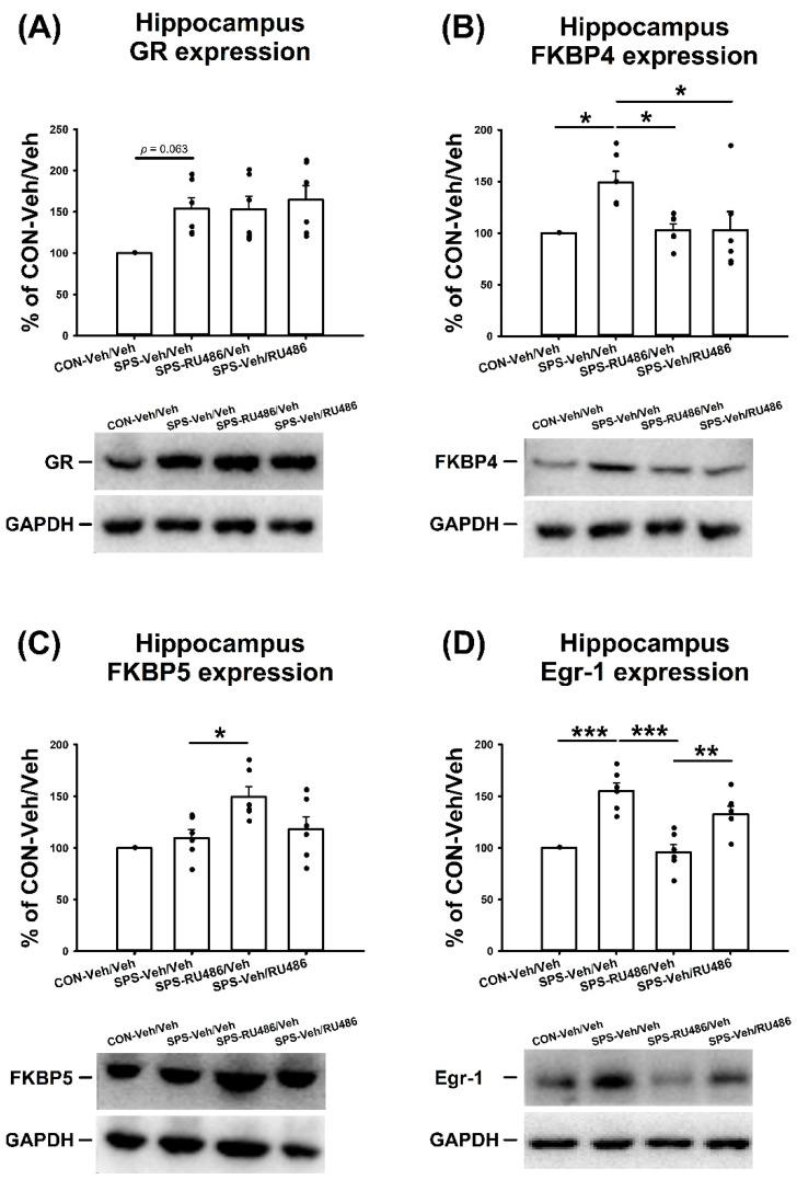 https://cdn.ncbi.nlm.nih.gov/pmc/blobs/9588/9141845/51316a850c1a/ijms-23-05494-g003.jpg