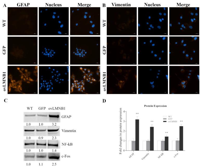 https://cdn.ncbi.nlm.nih.gov/pmc/blobs/9593/8534128/324f71e12949/cells-10-02566-g005.jpg