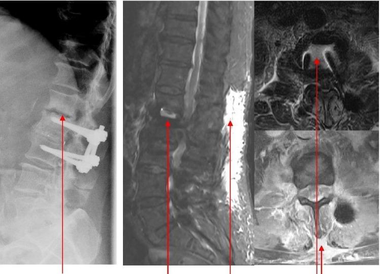https://cdn.ncbi.nlm.nih.gov/pmc/blobs/9595/4582483/87f5b1760220/IPRS-02-18-g-004.jpg