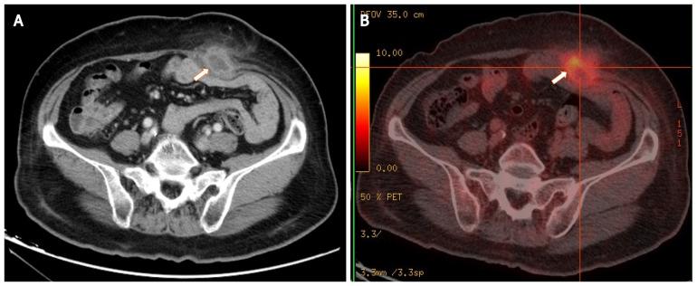https://cdn.ncbi.nlm.nih.gov/pmc/blobs/9599/8855253/334cf18c3b44/WJCC-10-1702-g001.jpg