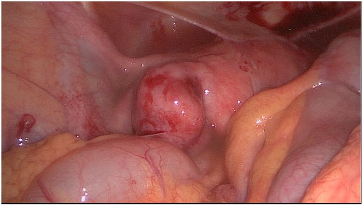 https://cdn.ncbi.nlm.nih.gov/pmc/blobs/9599/9225341/ed55ba893ee8/jcm-11-03278-g002.jpg