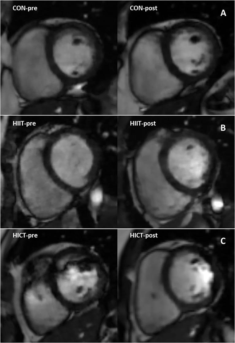https://cdn.ncbi.nlm.nih.gov/pmc/blobs/959e/10200876/4329cda3c281/fendo-14-1104441-g004.jpg