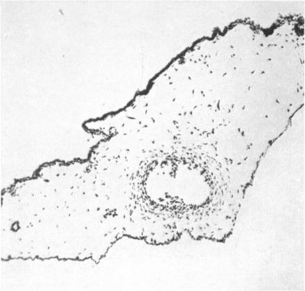 https://cdn.ncbi.nlm.nih.gov/pmc/blobs/95a1/2235035/4e01f40e98d3/jhyg00168-0147-a.jpg