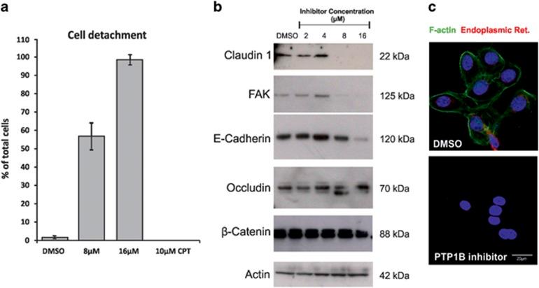 https://cdn.ncbi.nlm.nih.gov/pmc/blobs/95a1/5520702/3261bc094be3/cddis2017177f5.jpg